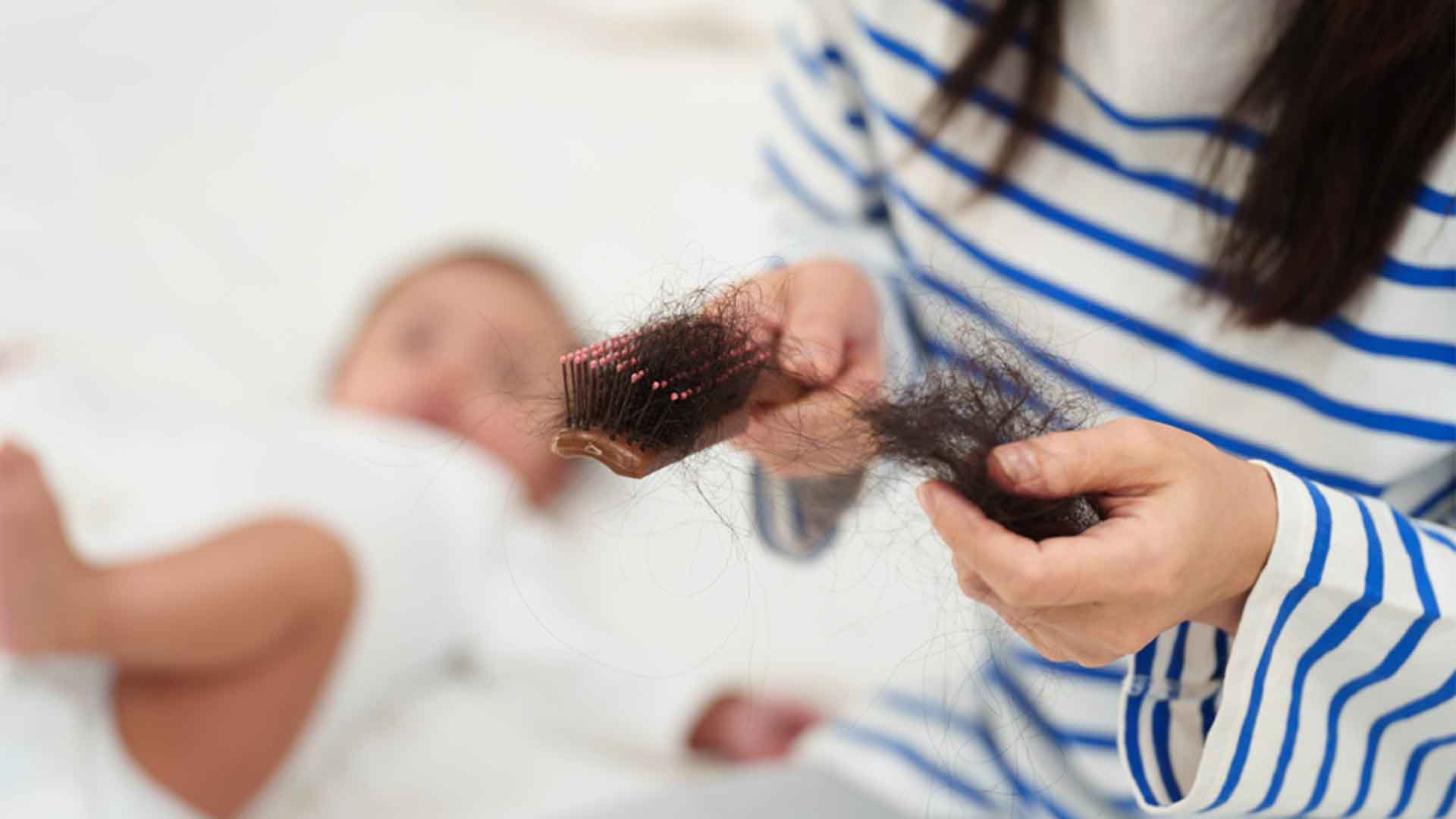 How To Deal With Postpartum Hair Fall